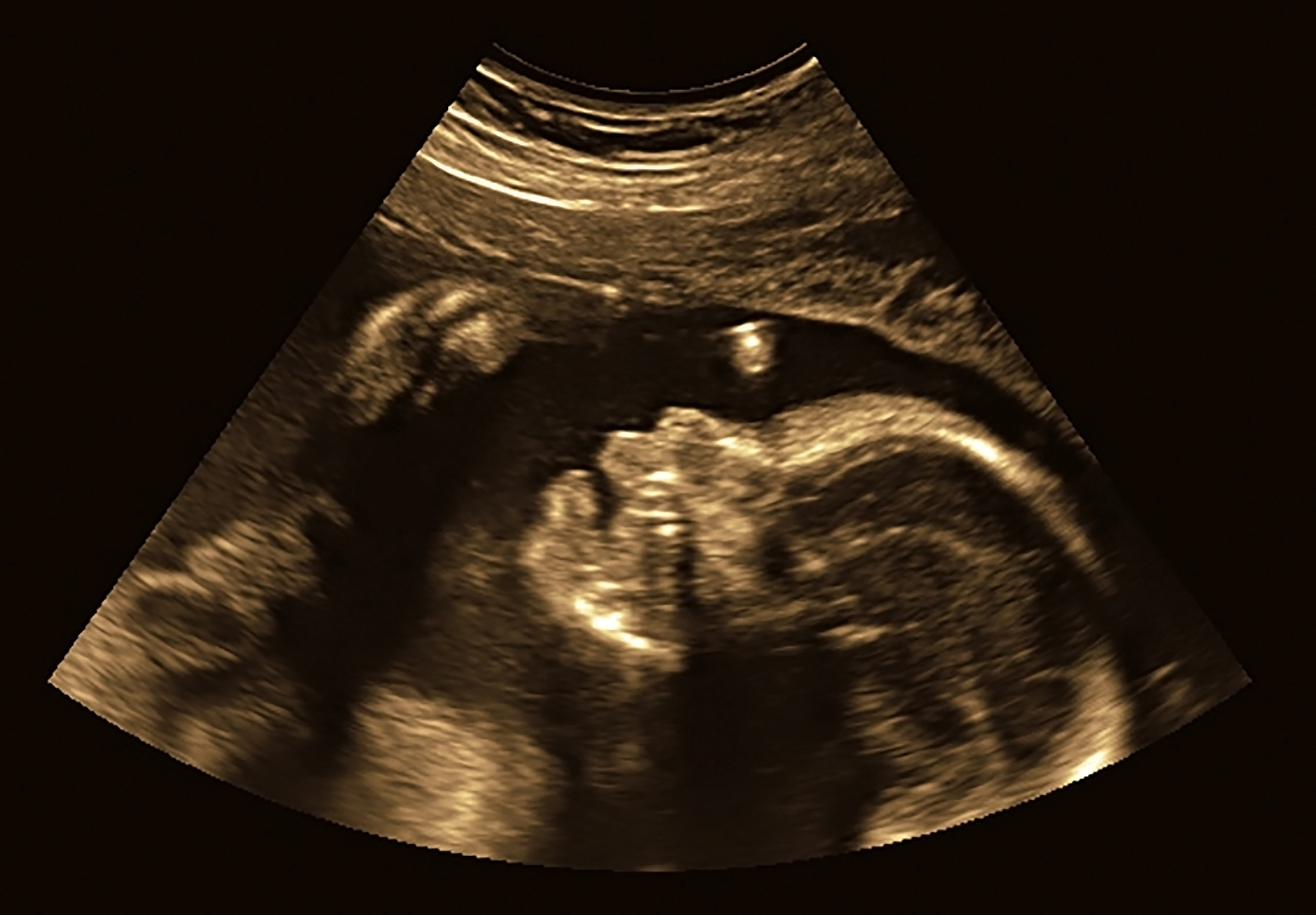 Top 6 Things About Being an Ultrasound Tech