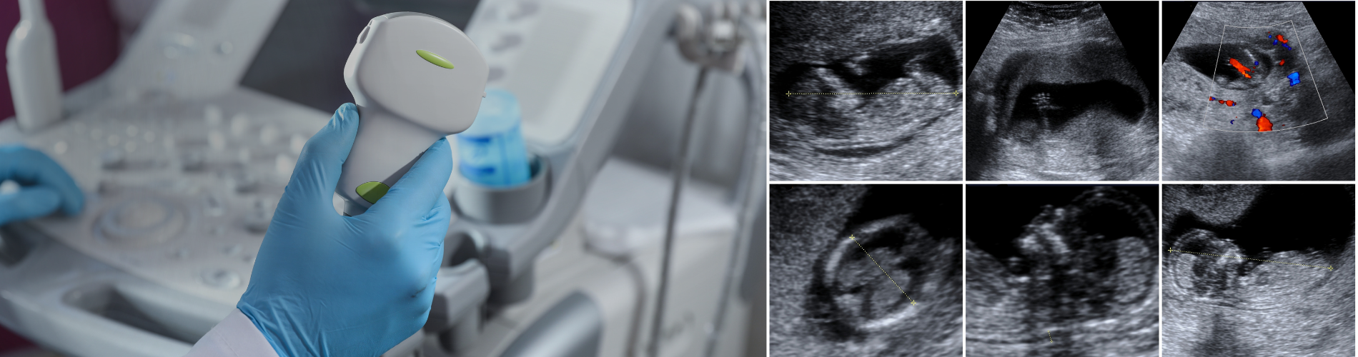 Your Guide to a Career as a Sonographer
